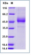 Human ICOS / AILIM / CD278 Recombinant Protein (Fc Tag)(Discontinued)