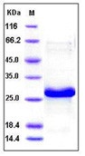 Human HSP27 / HSPB1 Recombinant Protein (His Tag)(Discontinued)