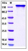 Human HER4 / ErbB4 Recombinant Protein (His & Fc Tag)(Discontinued)