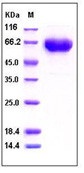 Human PD1 / PDCD1 Recombinant Protein (His & Fc Tag)(Discontinued)