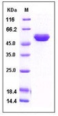 Human TIMP2 / TIMP-2 Recombinant Protein (Fc Tag)(Discontinued)