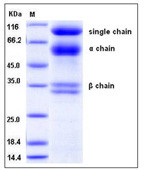 Human HGF / Hepatocyte Growth Factor Recombinant Protein(Discontinued)