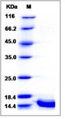 Human Cystatin A / CSTA Recombinant Protein (His Tag)(Discontinued)