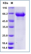 Human OX40 / CD134 Recombinant Protein (Fc Tag)(Discontinued)