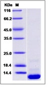 Human CCL20 / MIP-3 alpha Recombinant Protein (His Tag)(Discontinued)