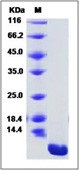 Human CCL18 / PARC / MIP4 Recombinant Protein (His Tag)(Discontinued)