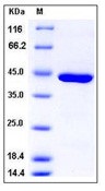 Human Carboxypeptidase A1 / CPA1 Recombinant Protein (His Tag)(Discontinued)