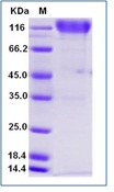 Human PDGFRB Recombinant Protein (Fc Tag)(Discontinued)