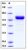 Human MMP1 Recombinant Protein (His Tag)(Discontinued)