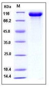 Human FGFR4 / FGF Receptor 4 Recombinant Protein (Fc Tag)(Discontinued)