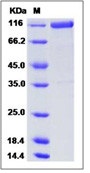 Human ENPEP / Aminopeptidase A Recombinant Protein (His Tag)(Discontinued)