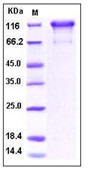 Human PDGFRa / CD140a Recombinant Protein (Fc Tag)(Discontinued)