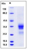 Human OLR1 / LOX1 Recombinant Protein (His Tag)(Discontinued)