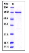 Human MEK2 / MAP2K2 / MKK2 Recombinant Protein (GST Tag)(Discontinued)