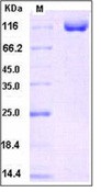 Human DPP4 / DPPIV / CD26 Recombinant Protein (Fc Tag)(Discontinued)