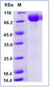 Human CD80 / B7-1 Recombinant Protein (Fc Tag)(Discontinued)