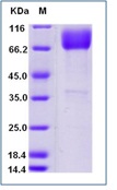 Human CD86 / B7-2 Recombinant Protein (Fc Tag)(Discontinued)