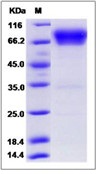 Human B7-H4 / B7S1 / B7x Recombinant Protein (Fc Tag)(Discontinued)