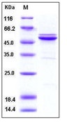 Human JNK2 / MAPK9 Recombinant Protein (His Tag)(Discontinued)