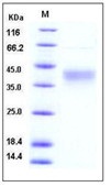 Human CD48 / SLAMF2 / BCM1 Recombinant Protein (His Tag)(Discontinued)