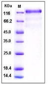 Human VEGFR3 / FLT4 Recombinant Protein (His Tag)(Discontinued)