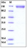 Human FGFR2 Recombinant Protein (His & Fc Tag)(Discontinued)