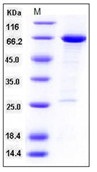 Human HDAC8 / HDACL1 Recombinant Protein (GST Tag)(Discontinued)