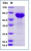 Human TNFRSF1A Recombinant Protein (Fc Tag)(Discontinued)