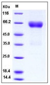 Human Ephrin-B2 / EFNB2 Recombinant Protein (His & Fc Tag)(Discontinued)