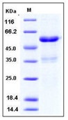 Human Ephrin-A1 / EFNA1 Recombinant Protein (His & Fc Tag)(Discontinued)