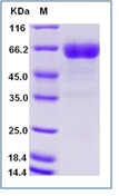 Human CD200 Recombinant Protein (Fc Tag)(Discontinued)