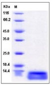 Human CCL15 / MIP-5 / MIP-1 delta Recombinant Protein (aa 22-113, His Tag)(Discontinued)