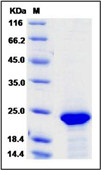 Human FGF21 Recombinant Protein (His Tag)(Discontinued)