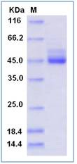 Human TIGIT / VSTM3 Recombinant Protein (Fc Tag)(Discontinued)