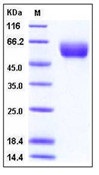 Human Angiotensinogen / SerpinA8 / AGT Recombinant Protein (His Tag)(Discontinued)