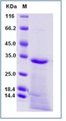 Human NGF / NGFB Recombinant Protein(Discontinued)