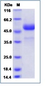 Human CTLA4 / CD152 Recombinant Protein (Fc Tag)(Discontinued)