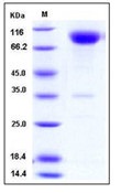 Human CD200R1 Recombinant Protein (His & Fc Tag)(Discontinued)