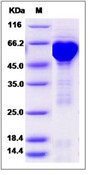 Human HSPD1 / HSP60 Recombinant Protein (His & GST Tag)(Discontinued)