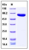 Human Carboxypeptidase B2 / CPB2 Recombinant Protein (His Tag)(Discontinued)