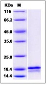 Human FGF6 / FGF-6 Recombinant Protein(Discontinued)