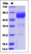 Human BTLA Recombinant Protein (Fc Tag)(Discontinued)