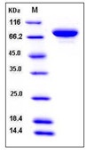 Human XPNPEP2 / X-Pro aminopeptidase 2 Recombinant Protein (His Tag)(Discontinued)