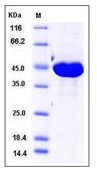 Human IDH1 Recombinant Protein (His Tag)(Discontinued)