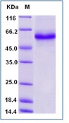 Human TNFRSF25 / DR3 / TNFRSF12 Recombinant Protein (Fc Tag)(Discontinued)