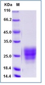 Human CD47 Recombinant Protein (His Tag)(Discontinued)