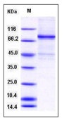 Human ELK1 Recombinant Protein (His & GST Tag)(Discontinued)