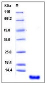 Human S100P / S100E Recombinant Protein(Discontinued)