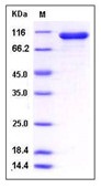 Human STAT1 / p91 Recombinant Protein (His & GST Tag)(Discontinued)