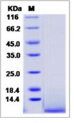 Human IGF-2 / IGF-II Recombinant Protein(Discontinued)